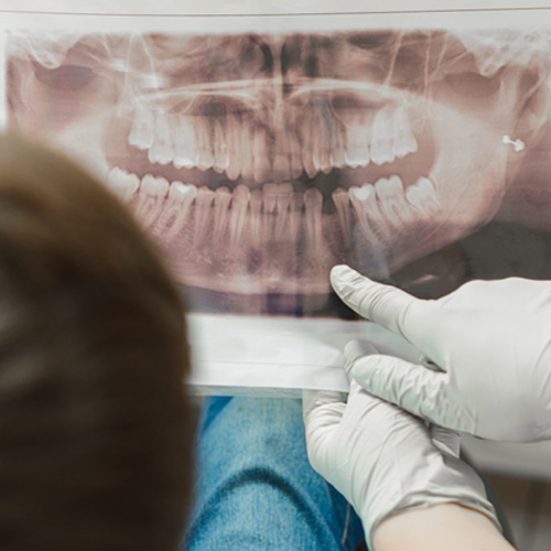 Dentist using AI to analyze X-ray